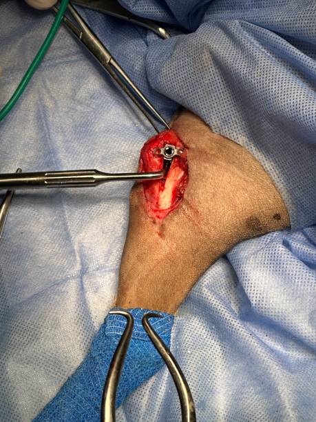 犬の膝蓋骨脱臼と十字靭帯断裂 - gauze scalpel surgeon healthcare and medicine ストックフォトと画像