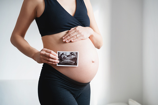 Pregnant woman holding ultrasound baby image. Pregnant belly and sonogram photo in hands of mother. Concept of pregnancy, gynecology, medical test, maternal health.