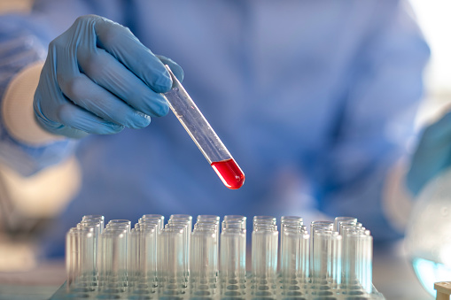 Scientist or laboratory researcher in protective mask and laboratory gloves investigating sample. Medical diagnosis, research and science background.