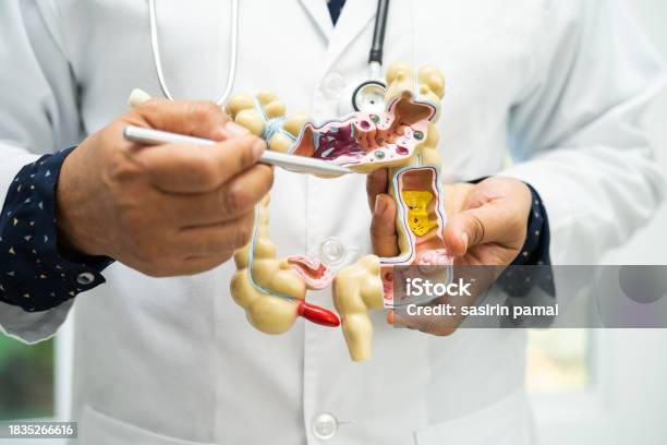 Usus Usus Buntu Dan Sistem Pencernaan Dokter Memegang Model Anatomi