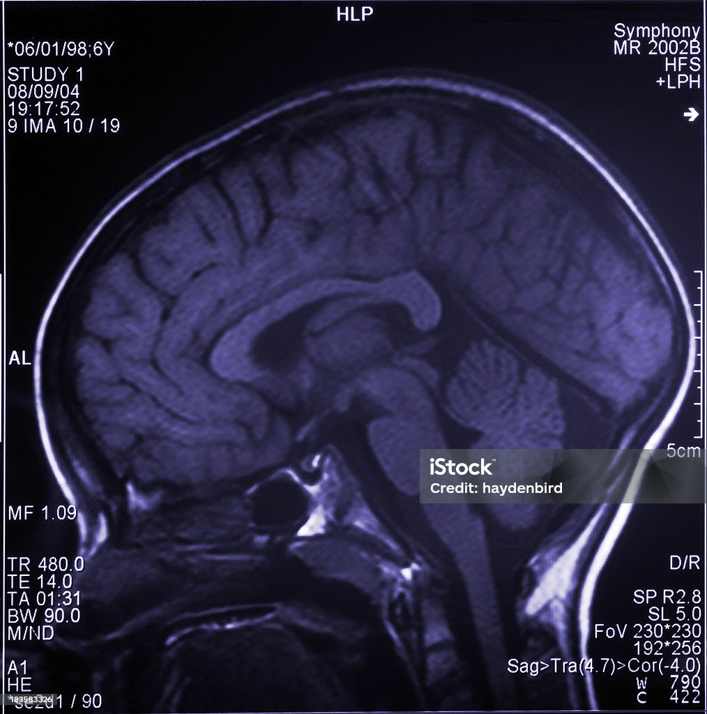 Cerveau montrant Scanner à résonance magnétique plusieurs images de la tête et du crâne - Photo de Image par résonance magnétique libre de droits