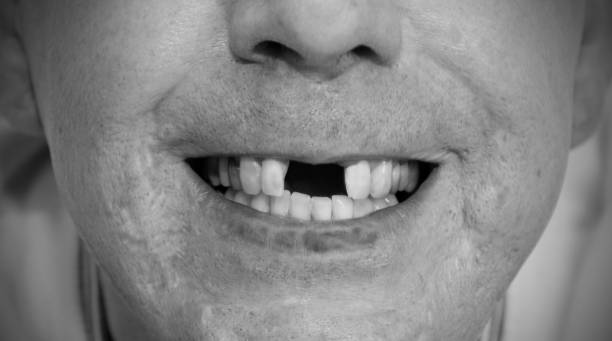 senza denti sorriso - toothless smile foto e immagini stock