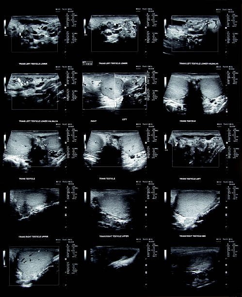 Testicular Ultrasound Testicular ultrasound film to check for problems testis stock pictures, royalty-free photos & images