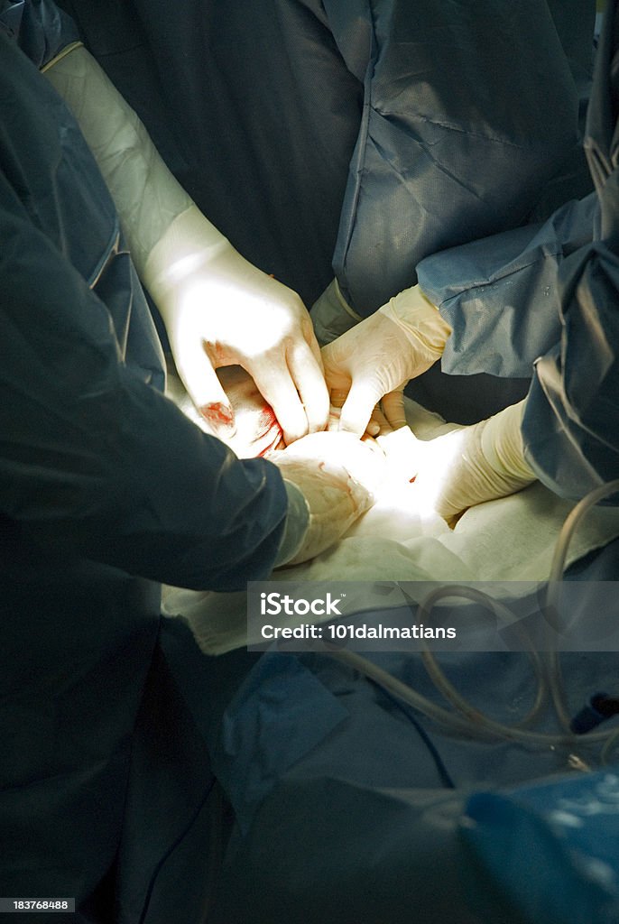Arzt auf Betrieb - Lizenzfrei Anästhesist Stock-Foto