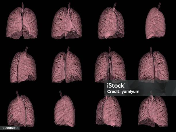 Photo libre de droit de 3 D Ct Scan Image Du Poumon Humain banque d'images et plus d'images libres de droit de Tomographie axiale informatisée - Tomographie axiale informatisée, Consultation médicale, Donnée