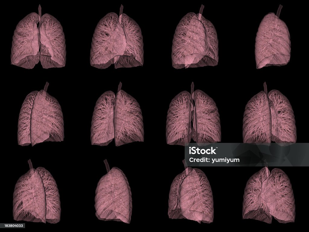 Scansione TC 3 D immagine di Polmone umano - Foto stock royalty-free di Tomografia computerizzata