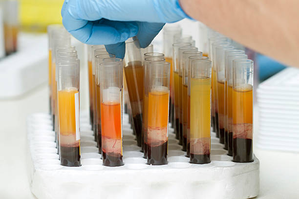 Blood tubes at the microbiology laboratory the blood cells are in the tubes at the laboratory of regional blood center. the laboratory assistant takes the tubes in the laboratory equipment for testing. the blue rubber  gloves must be used for the laboratory accreditation. they are testing essentially for immunohematology and serology. blood plasma stock pictures, royalty-free photos & images