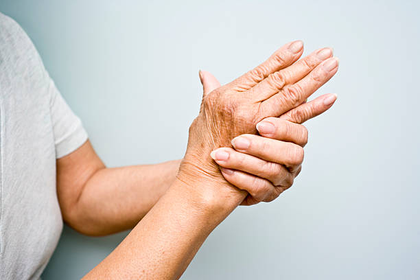 mujer de edad avanzada con artritis en sus manos - pain joint human hand arthritis fotografías e imágenes de stock