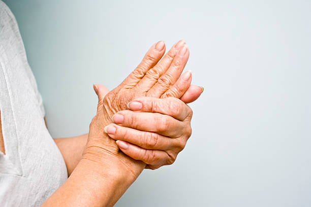 ältere frau greife arthritische hände - arthritis stock-fotos und bilder