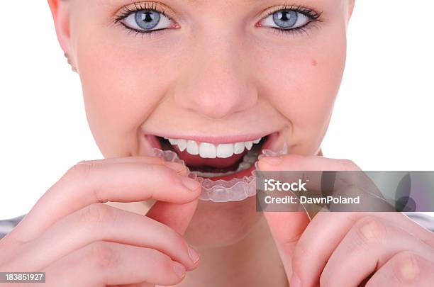 Foto de Peças e mais fotos de stock de Alinhador dentário - Alinhador dentário, Adolescente, Inserindo