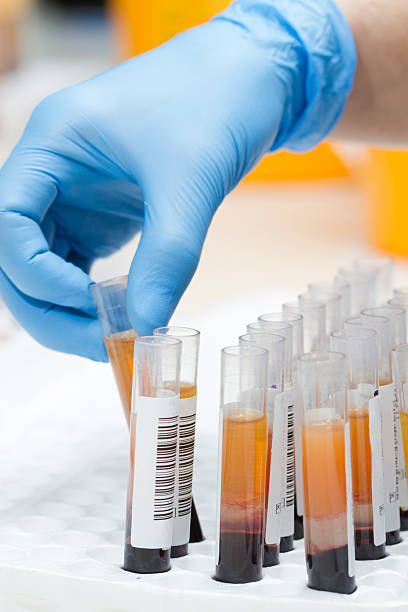 A lab technician with donation tests the blood cells are in the tubes, labelled ISBT bar codes ,at the laboratory of regional blood center. the laboratory assistant tests essentially for immunohematology and serology. blood plasma stock pictures, royalty-free photos & images