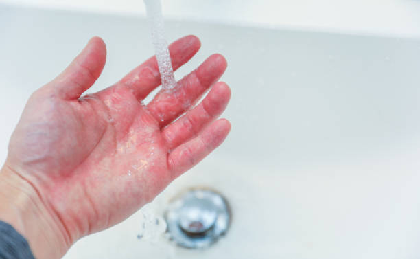 istock hands using hand sanitizer, promoting cleanliness and hygiene in everyday life 1839005986