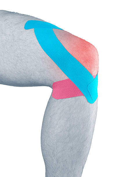 fisioterapia del ginocchio dolore, indolenzimento e iperteso - human knee physical injury bandage muscular build foto e immagini stock