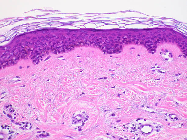 Skin tissue section "Cross section of normal human skin taken with microscope. Hematoxylin and Eosin (H&E) stain. Outer layer dead cells (top); epidermis (dark purple, middle); dermis (pink, bottom). More tissue sections:" histology photos stock pictures, royalty-free photos & images