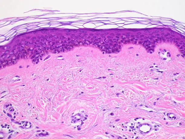 "Cross section of normal human skin taken with microscope. Hematoxylin and Eosin (H&E) stain. Outer layer dead cells (top); epidermis (dark purple, middle); dermis (pink, bottom). More tissue sections:"