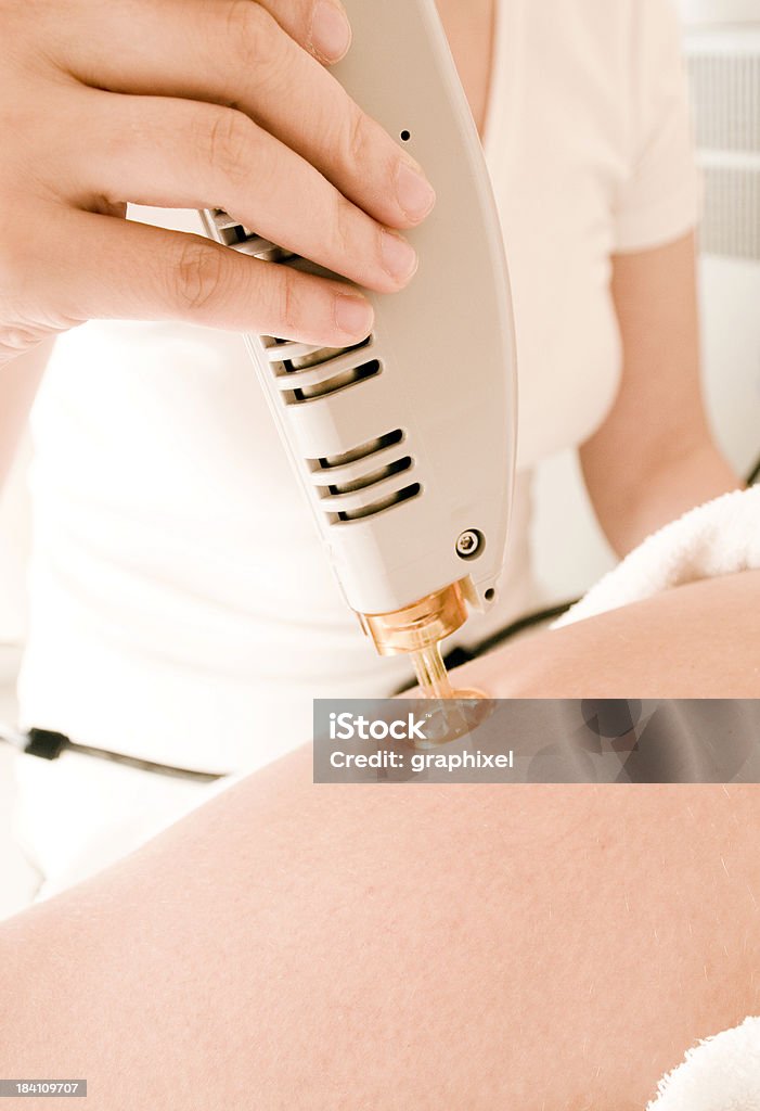 Epilation Laser - Foto stock royalty-free di Ceretta