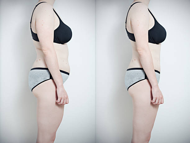 Before and after Before and after diet. Manipulate with photoshop. before and after weight loss stock pictures, royalty-free photos & images