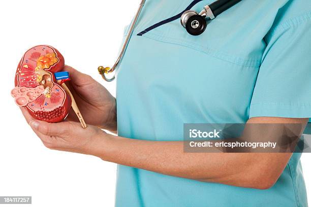 Ungesunde Kidney Stockfoto und mehr Bilder von Nierenstein - Nierenstein, Krankenpflegepersonal, Gesundheitswesen und Medizin