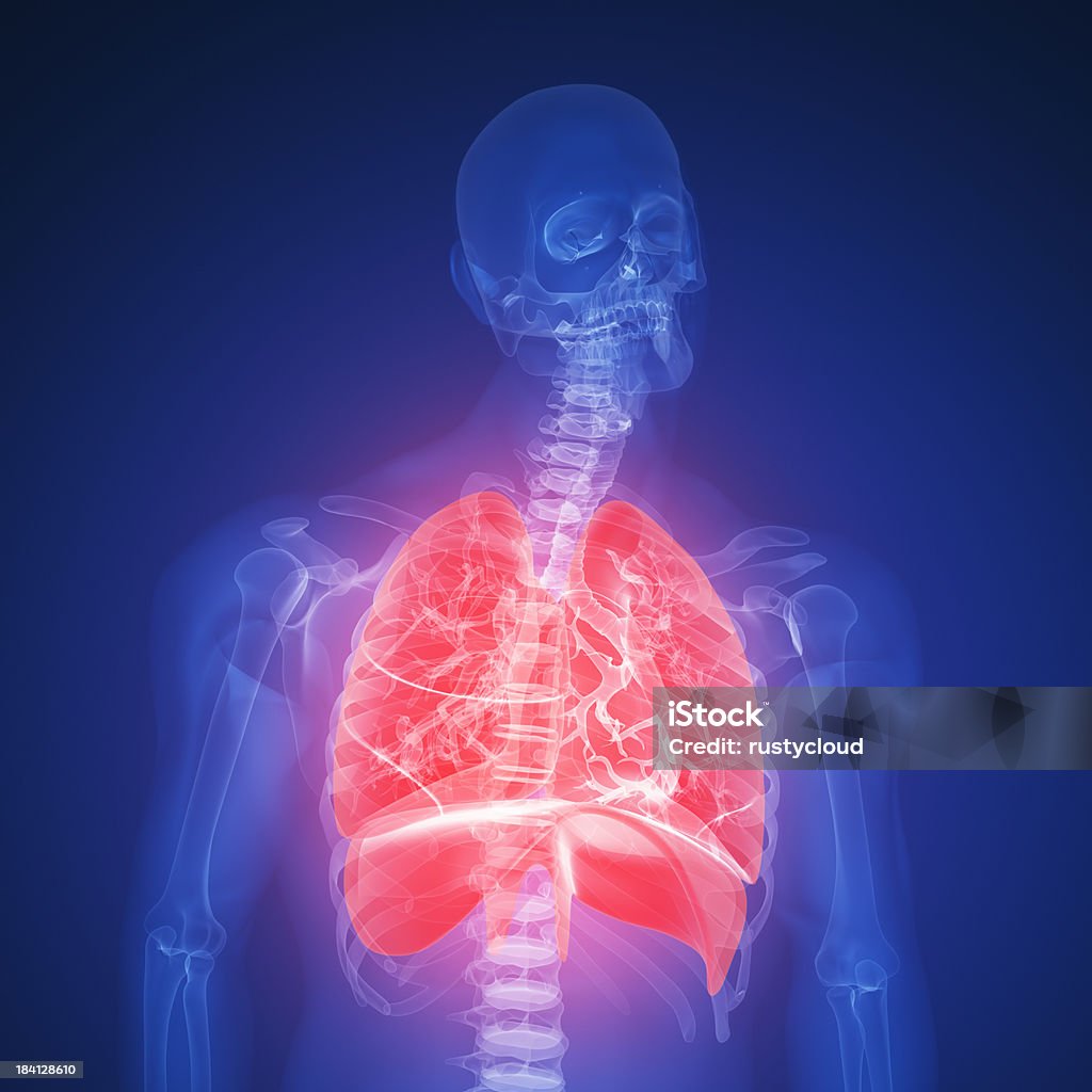 lung infection infection of an human lung.Please see some similar pictures from my portfolio: Anatomy Stock Photo