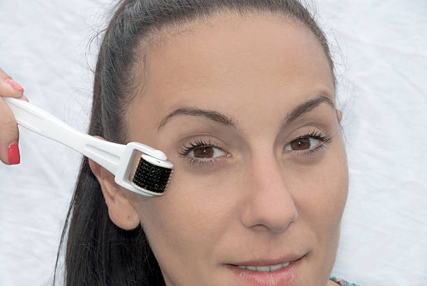 istock Girl with dermaroller 184132374