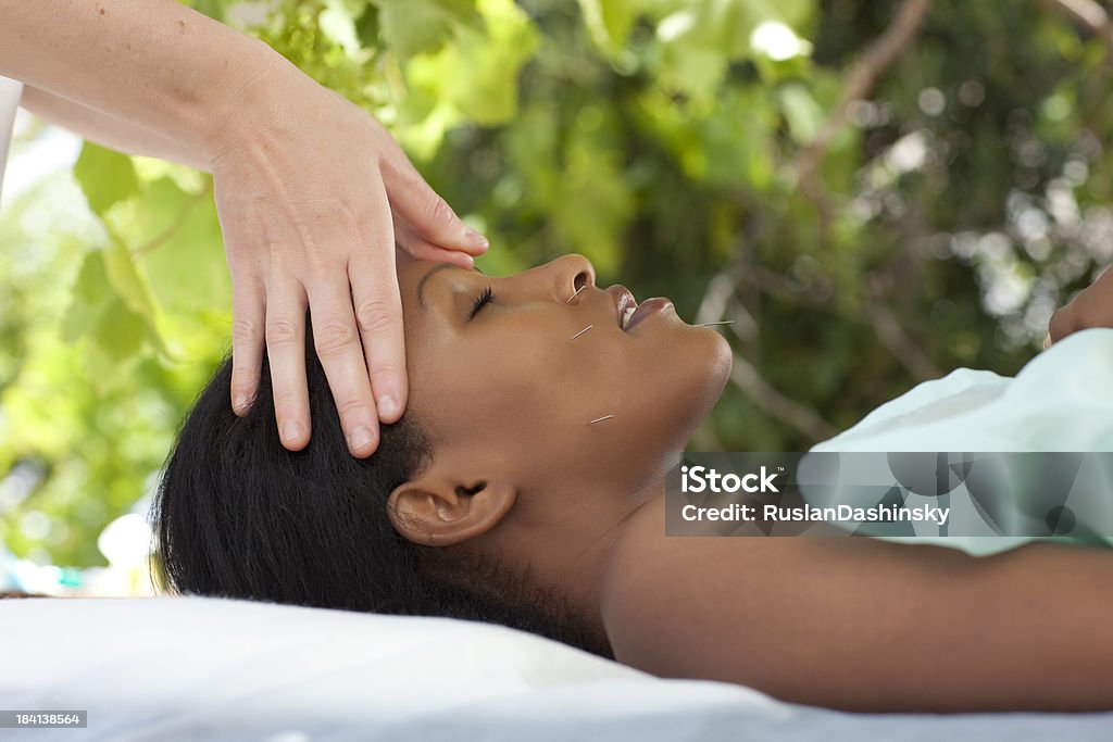 L'Acupuncture et un massage thérapeutique de la technique. - Photo de Aiguille - Mercerie libre de droits