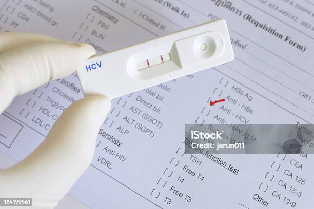 Hepatitis C Virus Positive Stock Photo - Download Image Now - Analyzing, Biology, Biotechnology