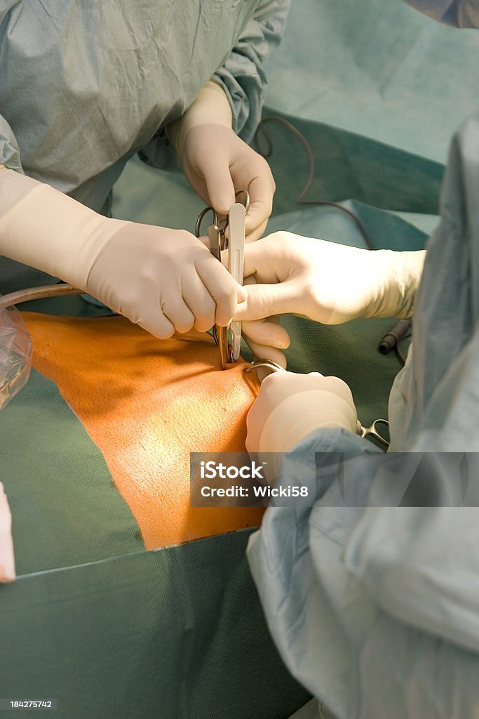 Navel Incision "Shot in an operating room, a surgeon makes an incision at the navel for laparoscopic abdominal surgery. Shallow depth of field, selective focus on wound, the wound is additional illuminated by a surgical spotlight." Abdomen Stock Photo