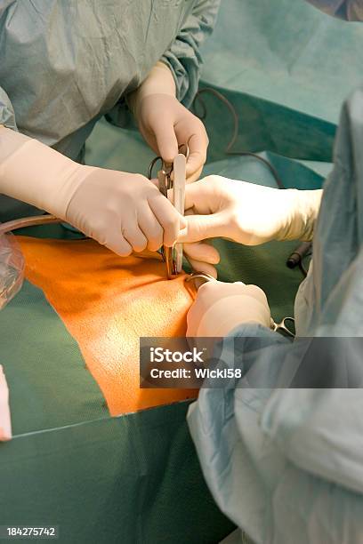 Navel Incision Stock Photo - Download Image Now - Abdomen, Wound, Belly Button