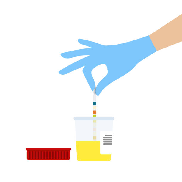 ilustrações, clipart, desenhos animados e ícones de amostra de urina, exame de urina, mão humana medindo a quantidade de ureia na urina - separating laboratory