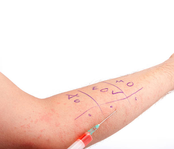 Red Skin Rash With Bumps, Scabs & Pimples Shown here is a bumpy red skin rash on a men arm. scab arm stock pictures, royalty-free photos & images