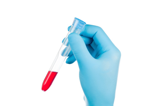 Hand protected by surgical glove holding a test tube with red liquid. Isolated on pure white.