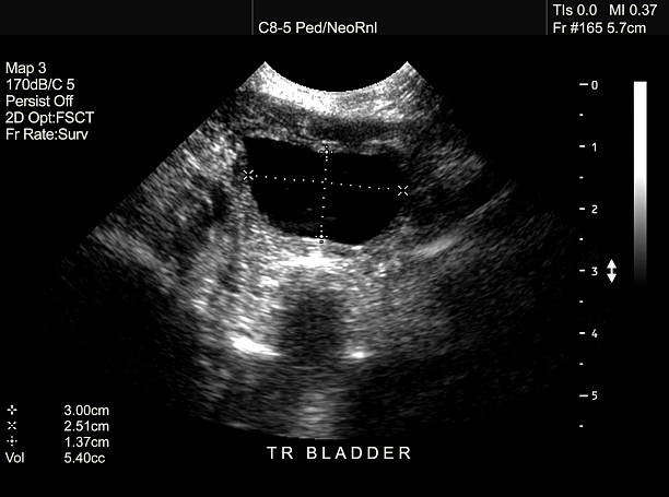 Ultrasound scan of newborn bladder stock photo