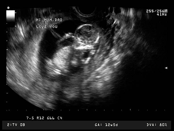 Prenatal Ultrasound Scan stock photo