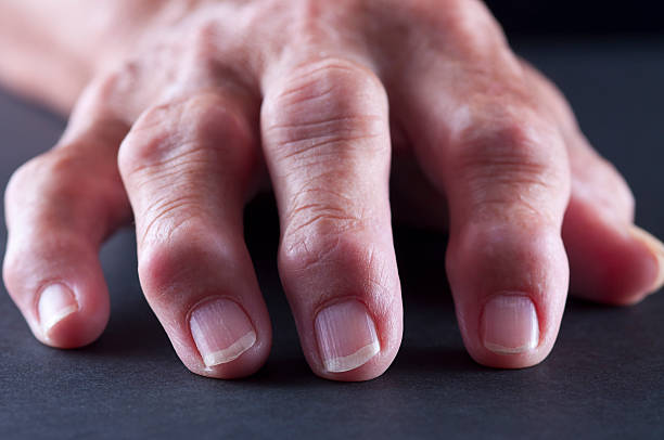 Arthitis Hand Selective-focus image of Arthritic/Senior Adult Hand shot on black knuckle joint stock pictures, royalty-free photos & images