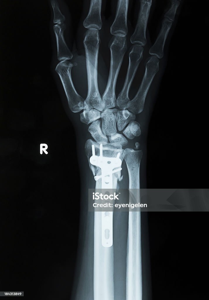 X-Ray - Foto de stock de Fotografía - Imágenes libre de derechos