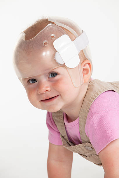 Baby Helmet Baby girl wearing a helmet for treatment of plagiocephaly plagiocephaly stock pictures, royalty-free photos & images