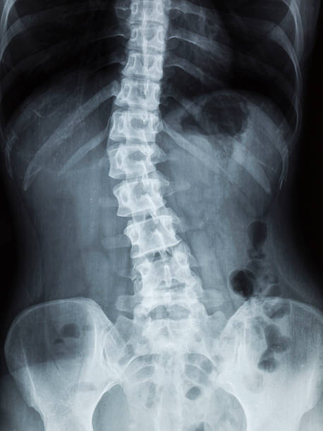 x-ray - human lung x ray image x ray human spine foto e immagini stock