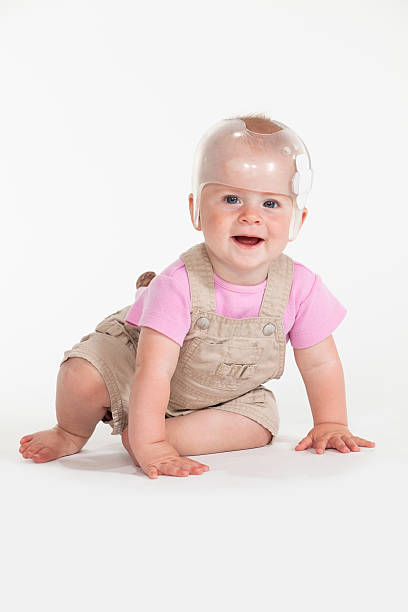 Baby Helmet Baby girl wearing a helmet for treatment of plagiocephaly plagiocephaly stock pictures, royalty-free photos & images