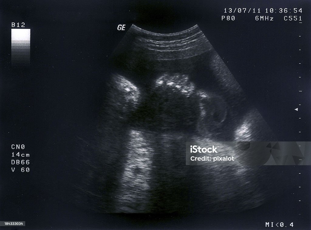 Ultrasound of a fetus, 31 weeks Highres scan of an ultrasonic of a 31 weeks old baby. Close up of a hand with fingers and finger nailsSee the whole series of fetal development stage by stage: Macrophotography Stock Photo