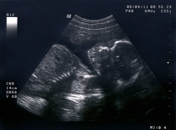 ultraschall-untersuchung von 16 wochen alter fötus - babies only audio stock-fotos und bilder
