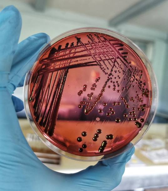istock Escherichia coli bacteria growth on Eosin Methylene Blue agar 1843666192