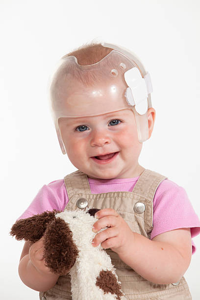 Baby Helmet Baby girl wearing a helmet for treatment of plagiocephaly plagiocephaly stock pictures, royalty-free photos & images