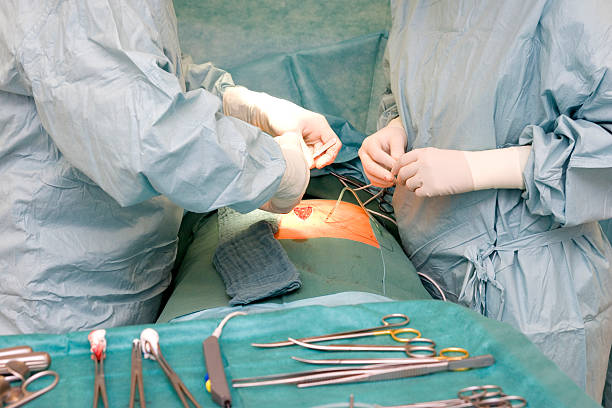 봉합하다 수술 상처 - sewing stitches thread surgery 뉴스 사진 이미지