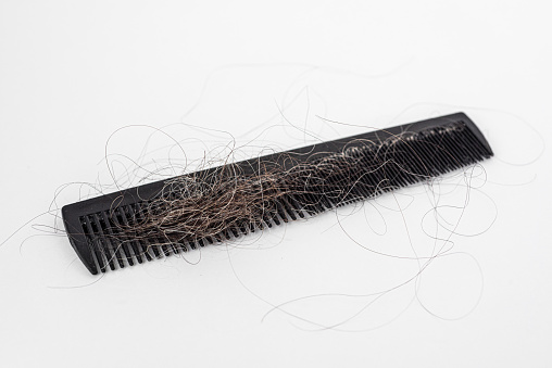 Lots of hair trapped in a comb