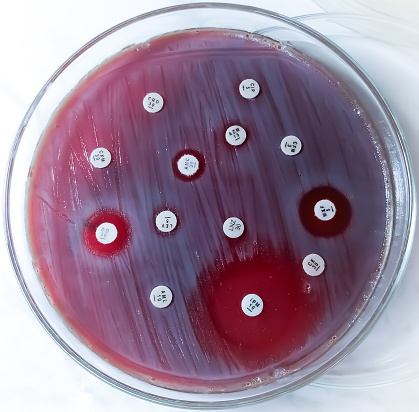 Antimicrobial susceptibility testing in petri dish