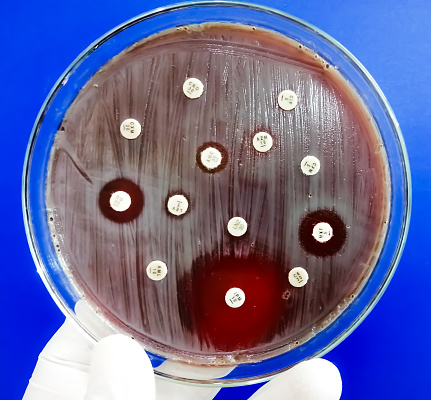 Antimicrobial susceptibility testing in petri dish showing Imipenem is sensitive and other antibiotics are resistance for this organism.