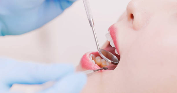 istock dentist check asian woman teeth 1844590481
