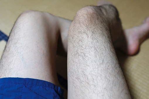 Unwanted hair on the thighs of Japanese men.