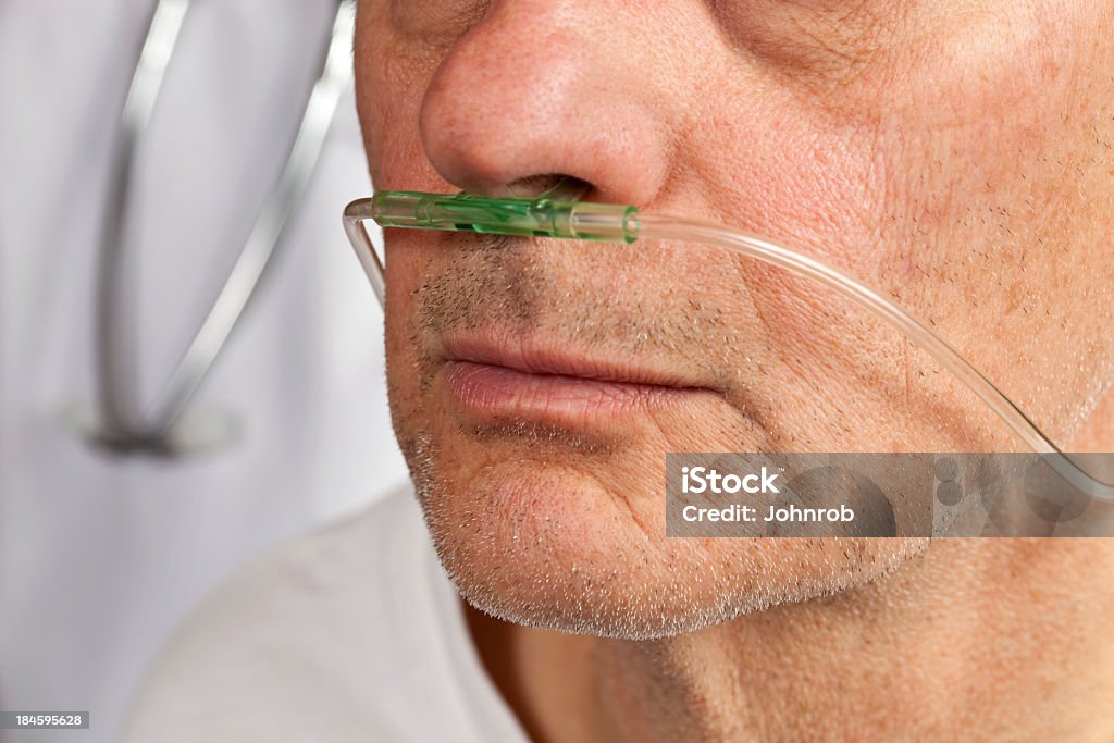Close-up del paziente faccia con tubo di respirazione nel naso - Foto stock royalty-free di Macchina per l'ossigeno