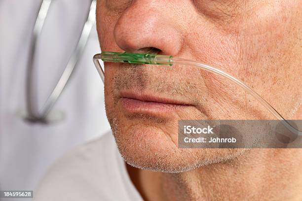 Closeup Del Paziente Faccia Con Tubo Di Respirazione Nel Naso - Fotografie stock e altre immagini di Macchina per l'ossigeno